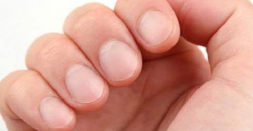 8 знаков на ногтях, говорящих о вашем здоровье